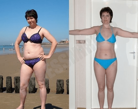 Keto Diet ilə arıqlamanın nəticəsi